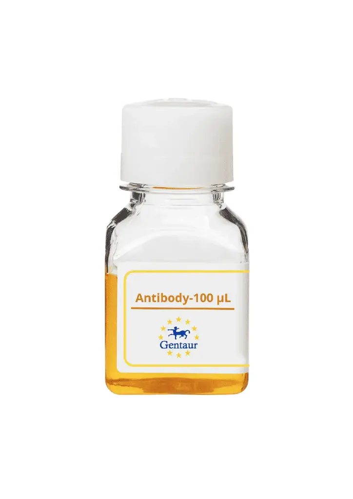 ALKBH3 Antibody   