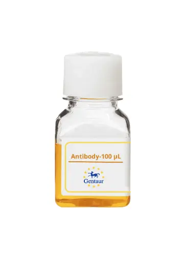 [PA019869GA01HU-100 µL] RNF20 Antibody