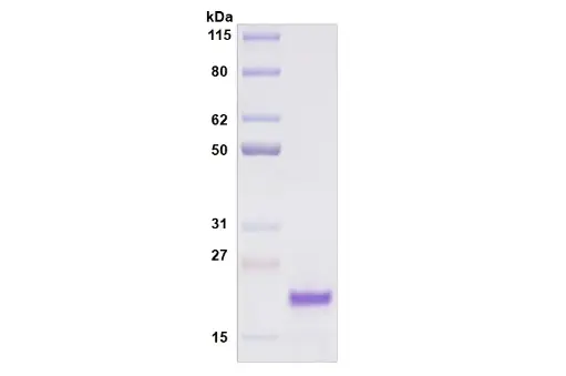 [MC11-100] Recombinant Human Siglec-8, His Tag -100 ug
