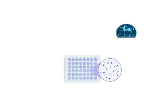 [ESR400G] ELISA Kits  IgG